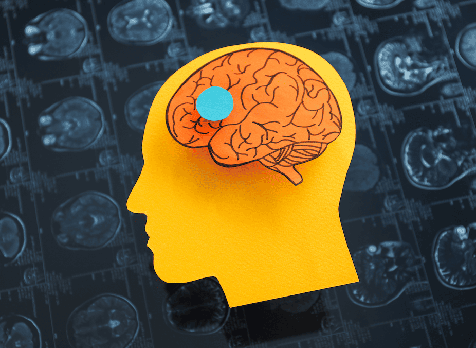 cerebro en estado de alerta